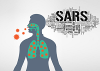 SARS LÀ BỆNH GÌ? LẦN ĐẦU XUẤT HIỆN Ở ĐÂU  - THEO WHO