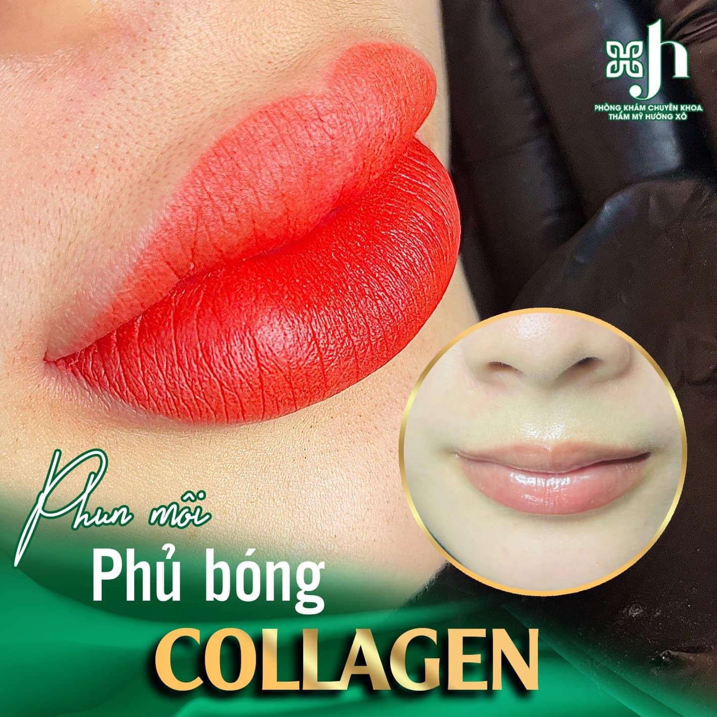 Phun môi collagen