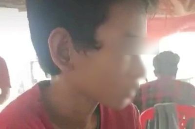 Bé trai ở An Giang bị cha dượng đốt bộ phận sinh dục