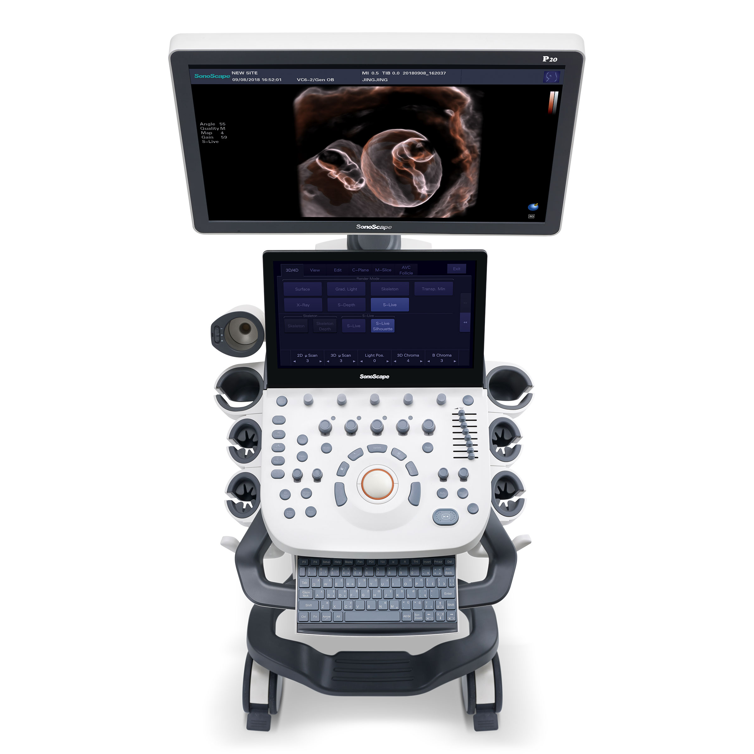 Máy siêu âm màu 5D P20 SonoScape- Công nghệ Mỹ