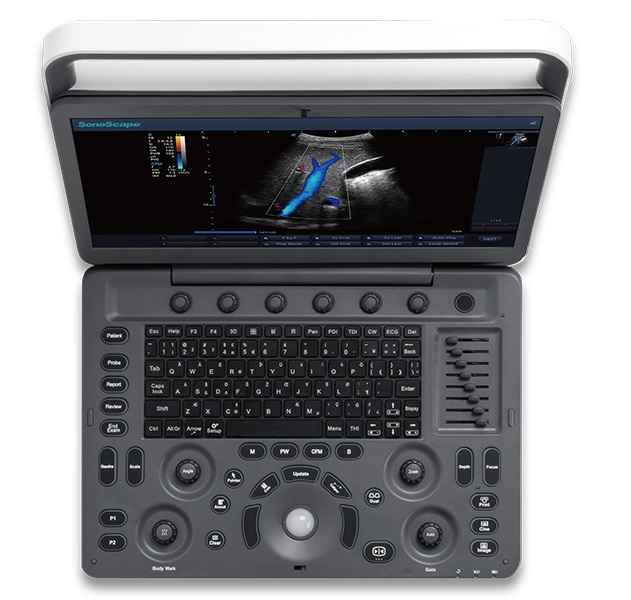 Máy siêu âm 2D SonoScape E2 chuyên tim SR Flow, Vis-Needle, TDI