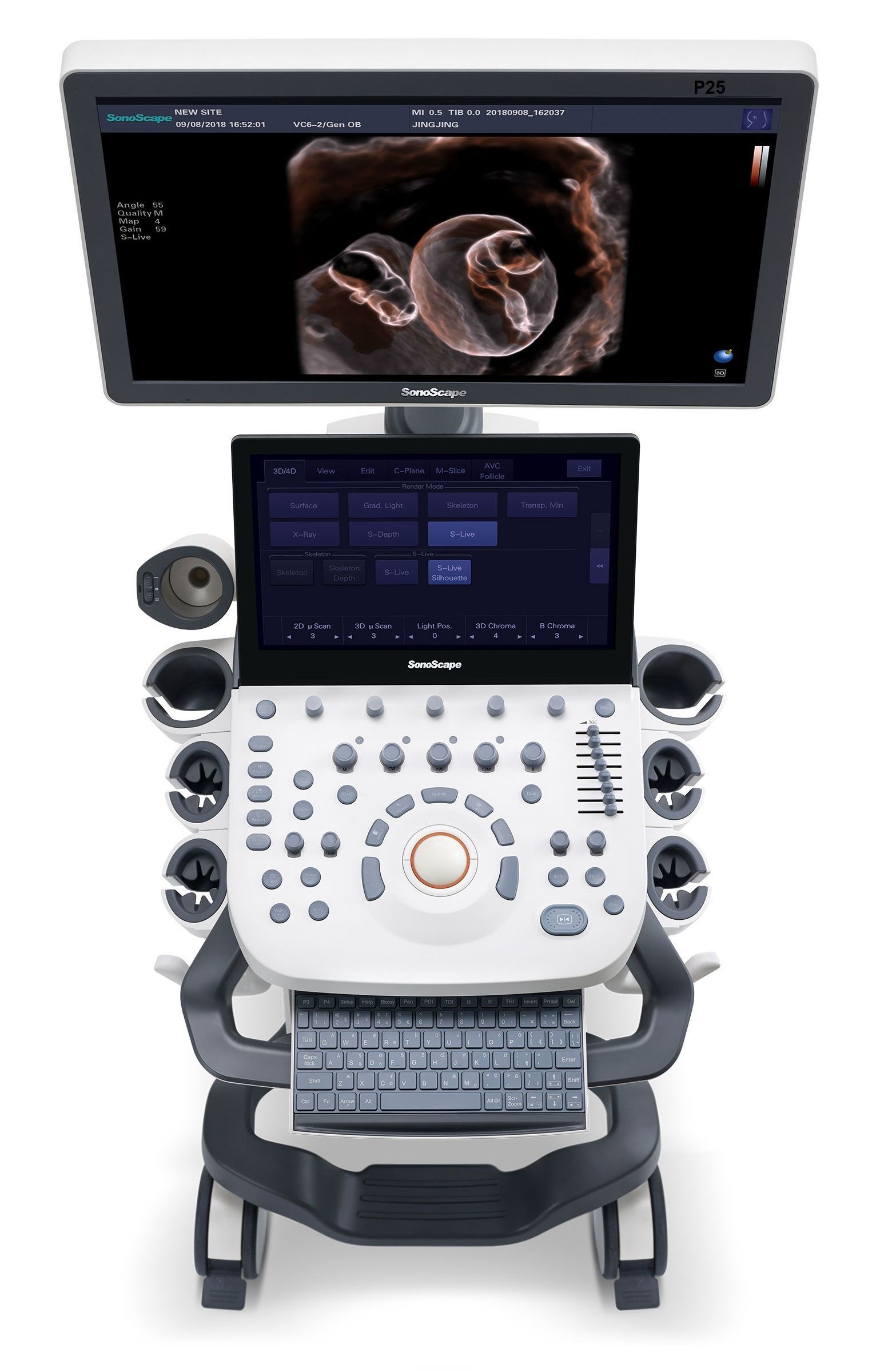 Máy siêu âm 5D SonoScape P20:  5D trong suốt - Đàn hồi mô