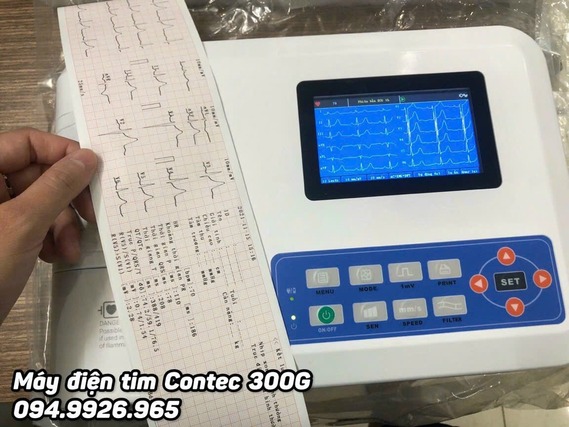 Máy đo điện tim 3 cần Contec ECG300GA - FDA Mỹ